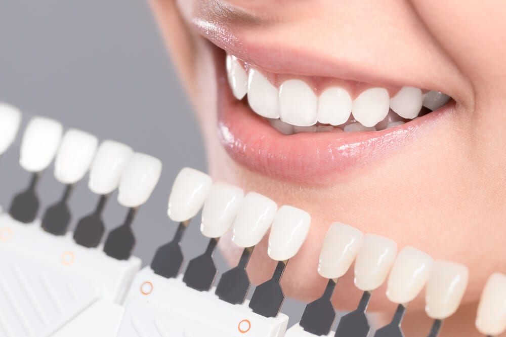 teeth whitening res